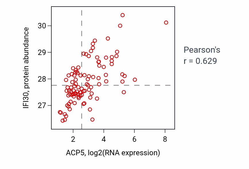 Per-sample scatter of ACP5 vs IFI30 in GBM (Pearson r = 0.63).