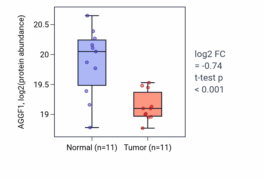 Tumor-vs-normal mass-spec protein box plot for AGGF1 in PDAC.