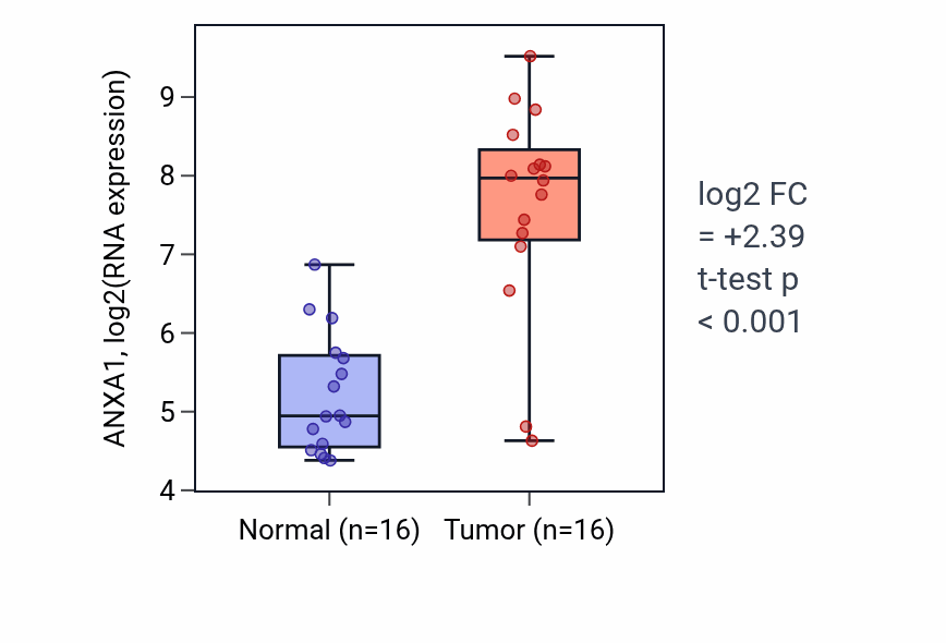 Tumor-vs-normal expression box plot for ANXA1 in KIRP.