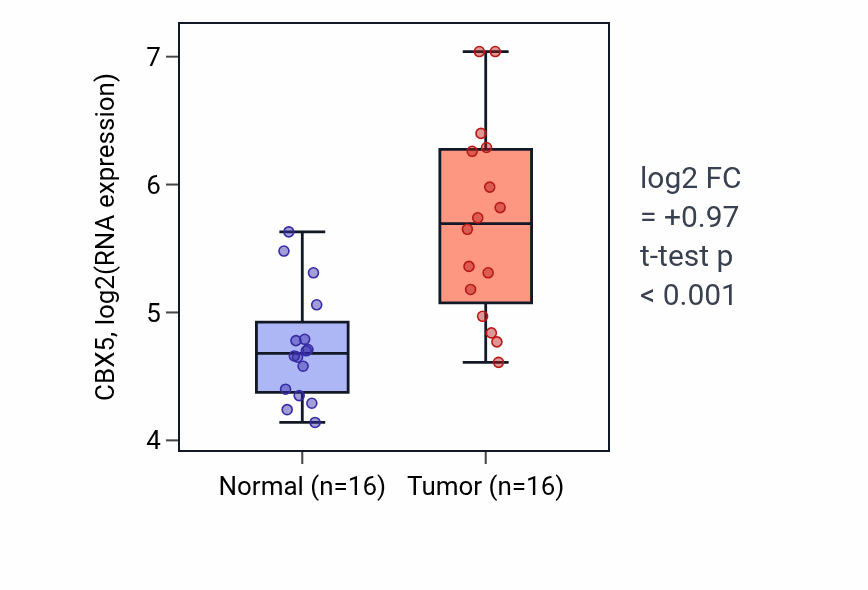 Tumor-vs-normal expression box plot for CBX5 in KIRP.