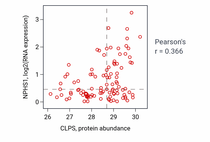 Per-sample scatter of CLPS vs NPHS1 in PDAC (Pearson r = 0.37).
