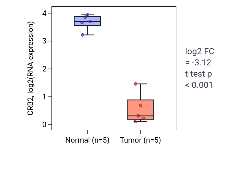Tumor-vs-normal expression box plot for CRB2 in KIRP.