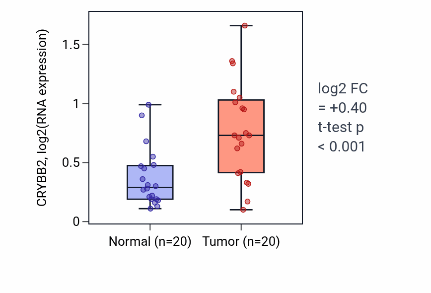 Tumor-vs-normal expression box plot for CRYBB2 in KIRC.