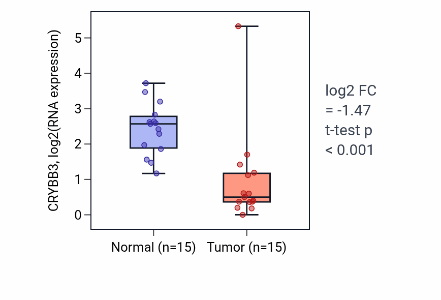 Tumor-vs-normal expression box plot for CRYBB3 RNA in KIRP.
