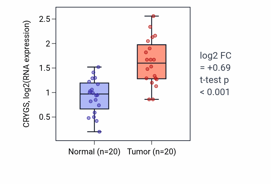 Tumor-vs-normal expression box plot for CRYGS in KIRC.