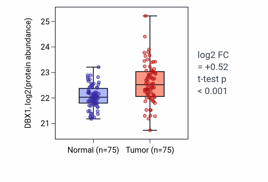 Tumor-vs-normal mass-spec protein box plot for DBX1 in LSCC.