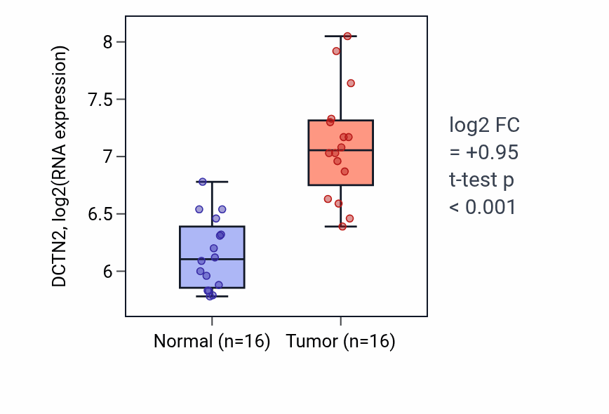 Tumor-vs-normal expression box plot for DCTN2 in KIRP.