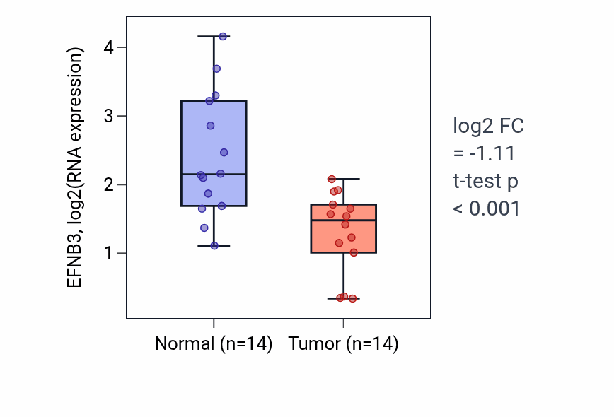 Tumor-vs-normal expression box plot for EFNB3 RNA in KIRC.