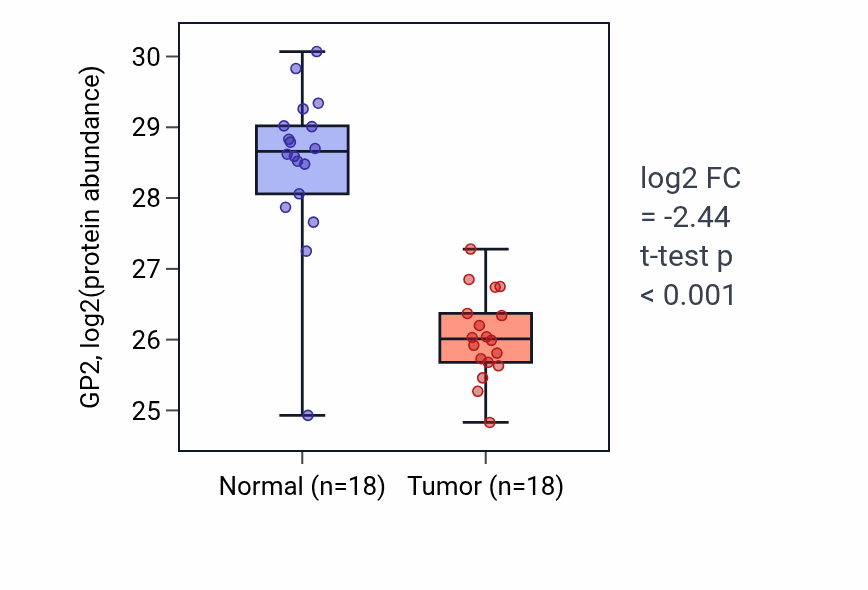 Tumor-vs-normal mass-spec protein box plot for GP2 in PDAC.