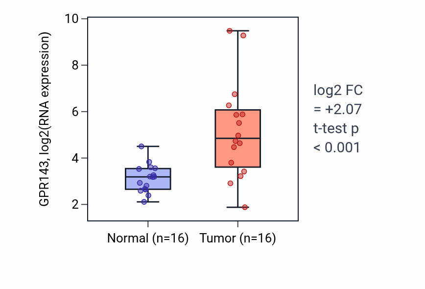 Tumor-vs-normal expression box plot for GPR143 in KIRP.