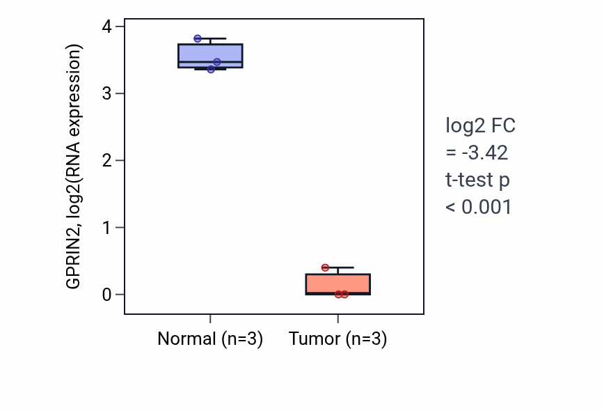 Tumor-vs-normal expression box plot for GPRIN2 in KICH.