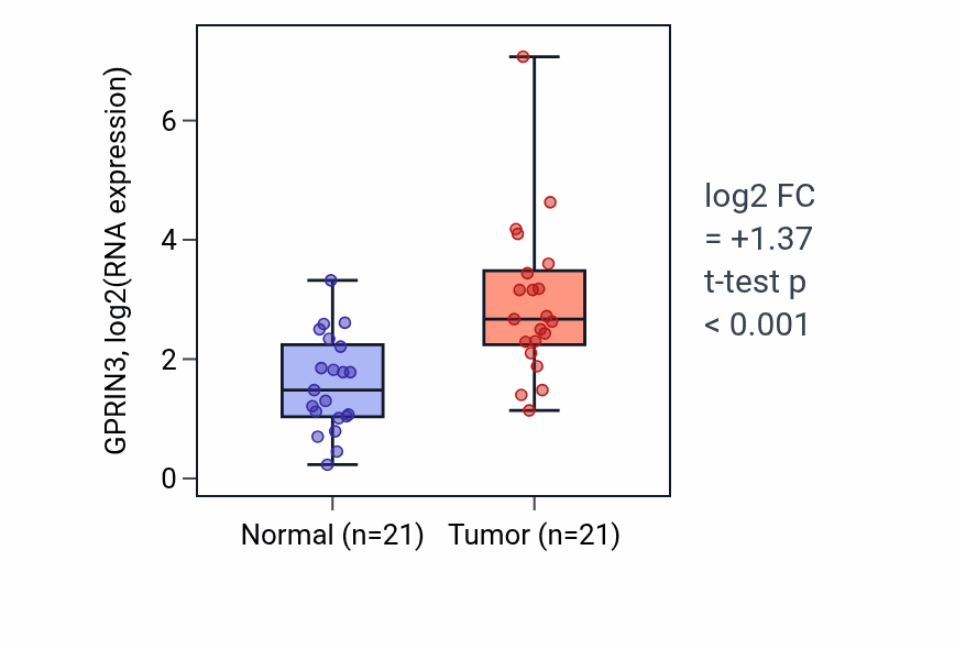Tumor-vs-normal expression box plot for GPRIN3 in STAD.