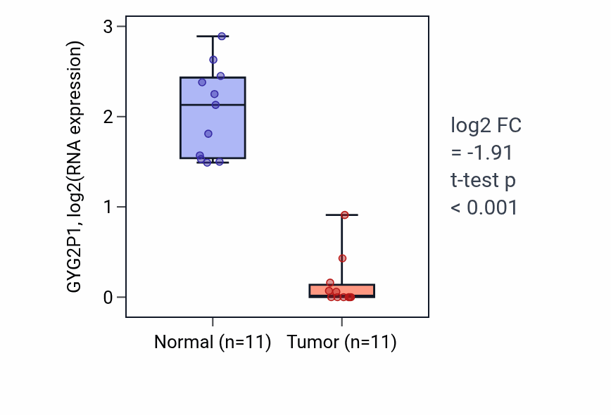 Tumor-vs-normal expression box plot for GYG2P1 in KIRP.
