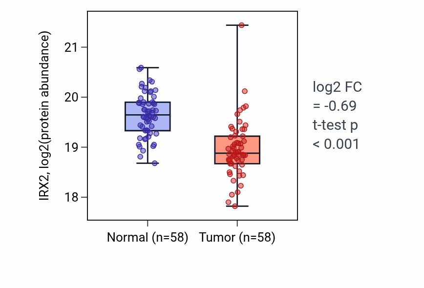Tumor-vs-normal mass-spec protein box plot for IRX2 in LSCC.