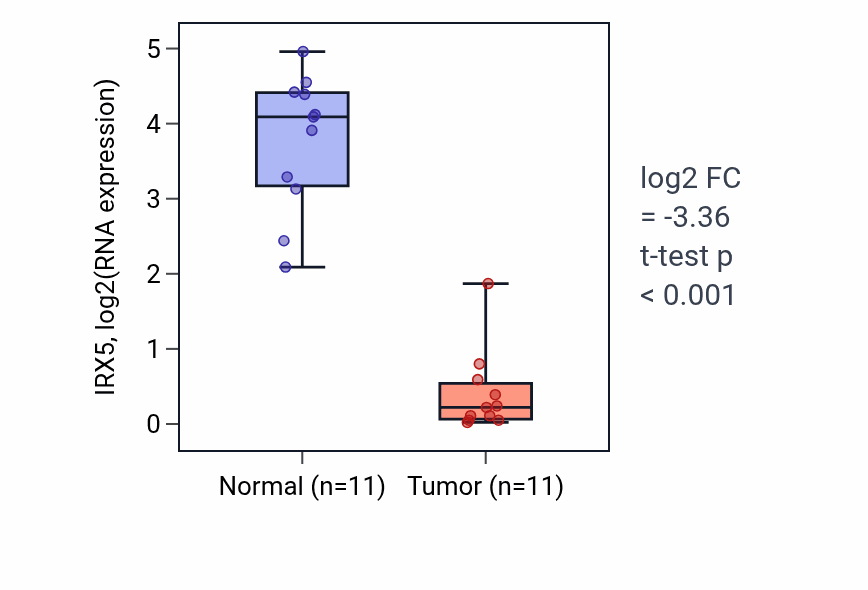 Tumor-vs-normal expression box plot for IRX5 in KICH.