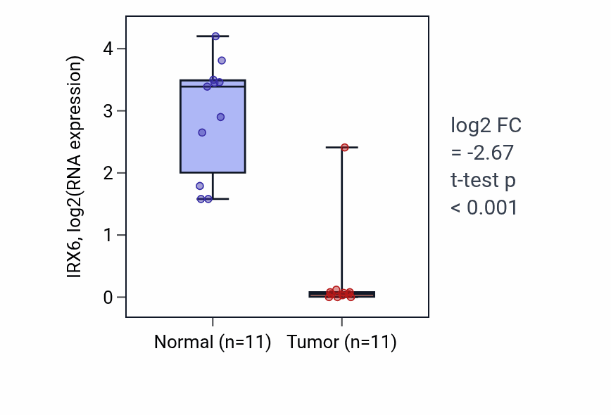 Tumor-vs-normal expression box plot for IRX6 in KICH.