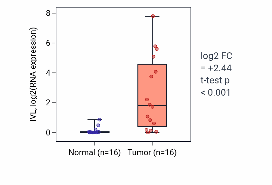 Tumor-vs-normal expression box plot for IVL in THCA.