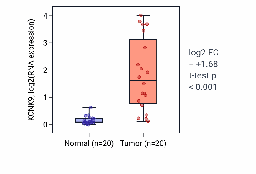 Tumor-vs-normal expression box plot for KCNK9 in KIRC.
