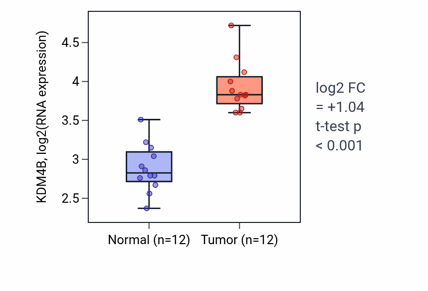 Tumor-vs-normal expression box plot for KDM4B in KIRC.