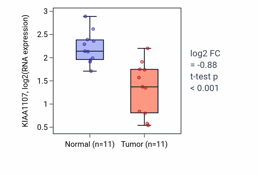 Tumor-vs-normal expression box plot for KIAA1107 RNA in KICH.