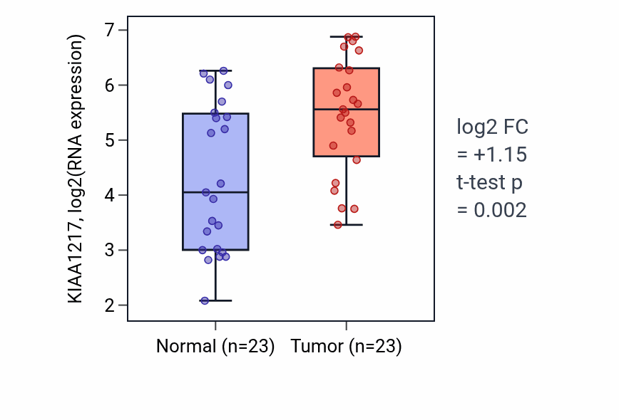 Tumor-vs-normal expression box plot for KIAA1217 in UCEC.