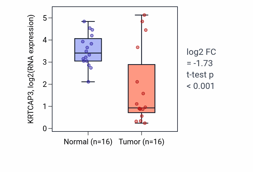 Tumor-vs-normal expression box plot for KRTCAP3 in KIRP.