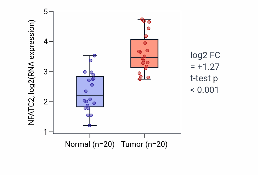 Tumor-vs-normal expression box plot for NFATC2 RNA in KIRC.