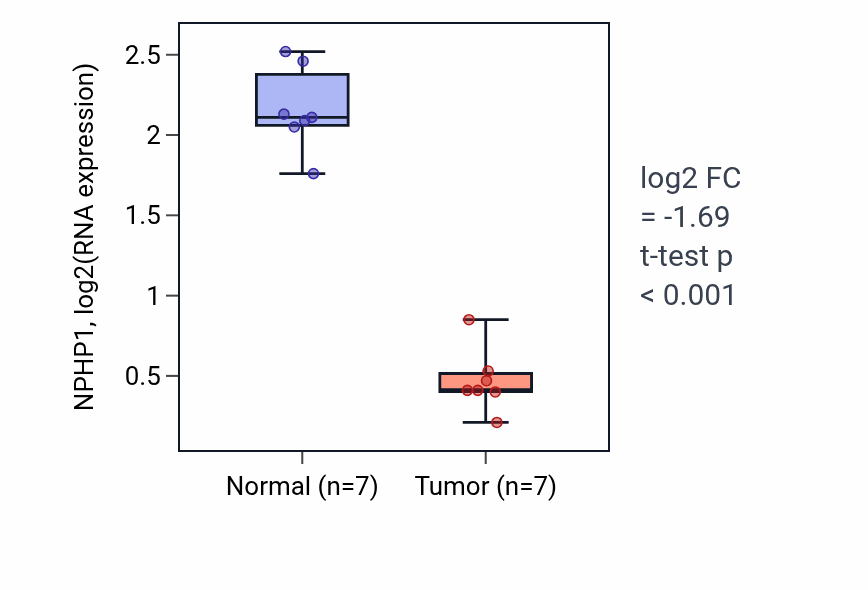Tumor-vs-normal expression box plot for NPHP1 RNA in KICH.