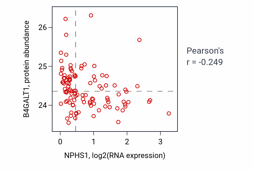 Per-sample scatter of NPHS1 vs B4GALT1 in PDAC (Pearson r = -0.25).