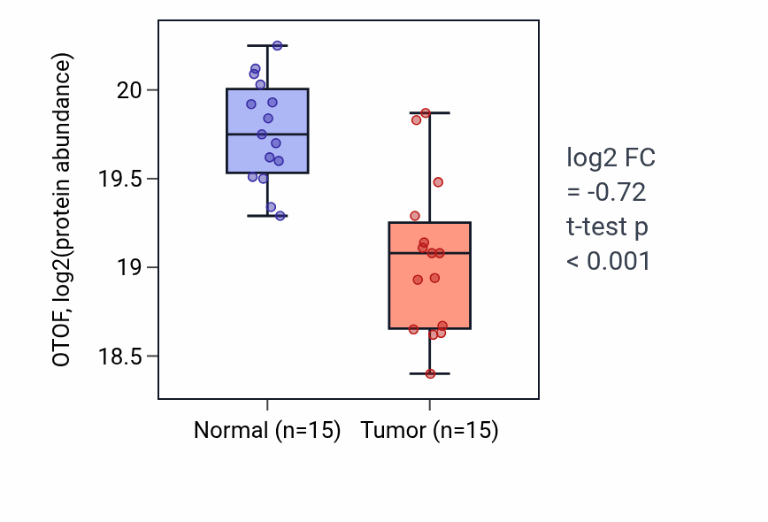 Tumor-vs-normal mass-spec protein box plot for OTOF in LSCC.