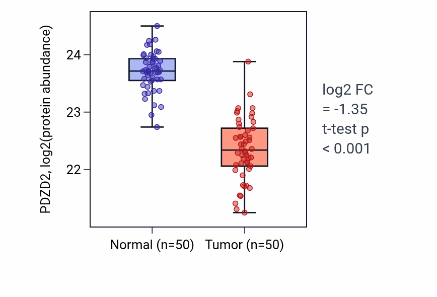 Tumor-vs-normal mass-spec protein box plot for PDZD2 in LSCC.