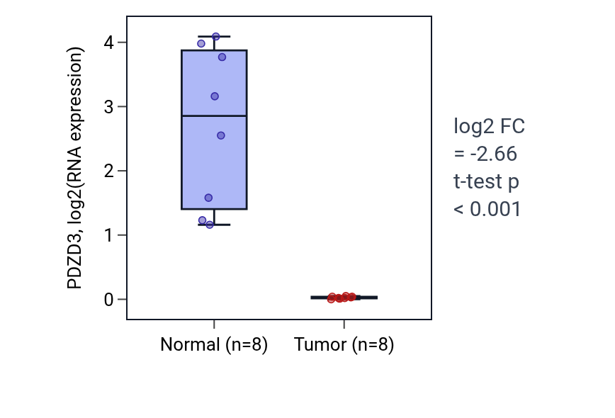 Tumor-vs-normal expression box plot for PDZD3 in KICH.