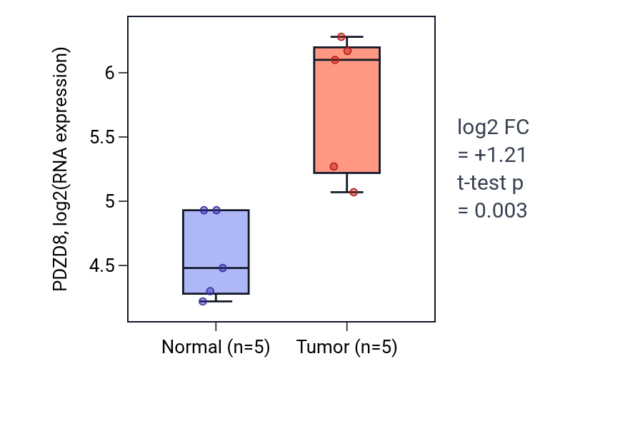 Tumor-vs-normal expression box plot for PDZD8 in KIRP.