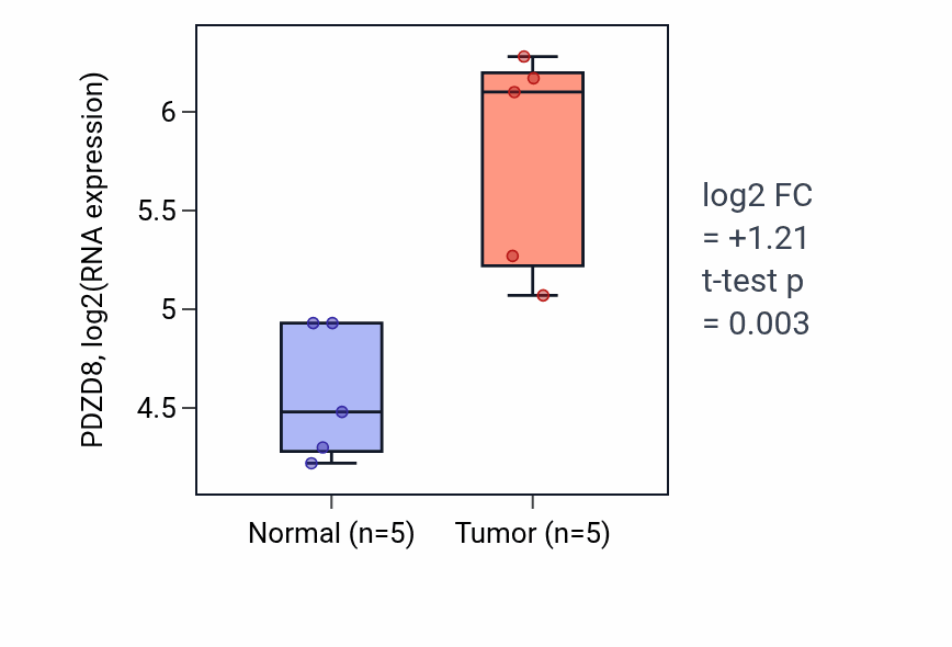 Tumor-vs-normal expression box plot for PDZD8 RNA in KIRP.