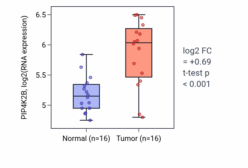 Tumor-vs-normal expression box plot for PIP4K2B RNA in KIRP.