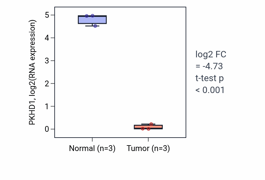 Tumor-vs-normal expression box plot for PKHD1 RNA in KICH.