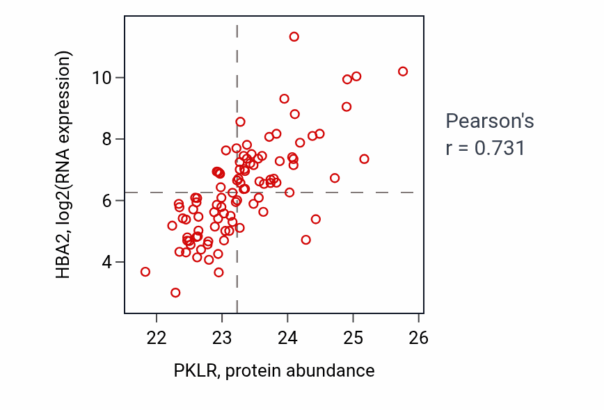 Per-sample scatter of PKLR vs HBA2 in GBM (Pearson r = 0.73).