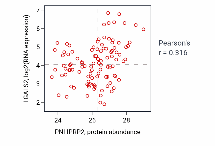 Per-sample scatter of PNLIPRP2 vs LGALS2 in PDAC (Pearson r = 0.32).
