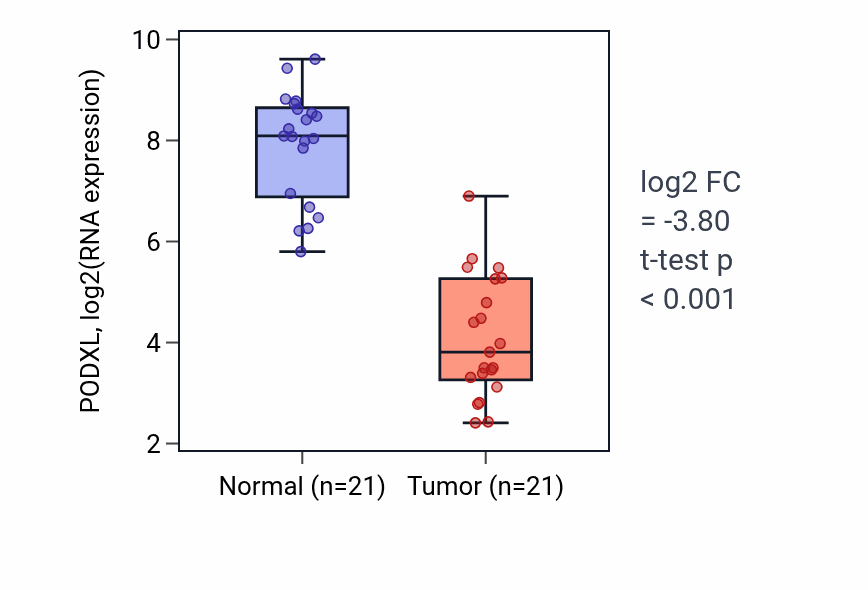 Tumor-vs-normal expression box plot for PODXL RNA in KIRP.