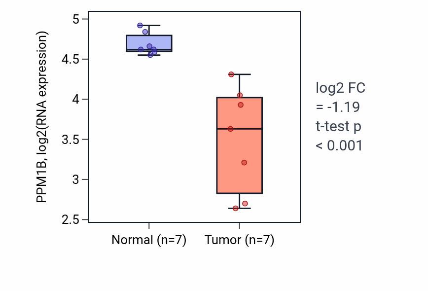 Tumor-vs-normal expression box plot for PPM1B RNA in KICH.
