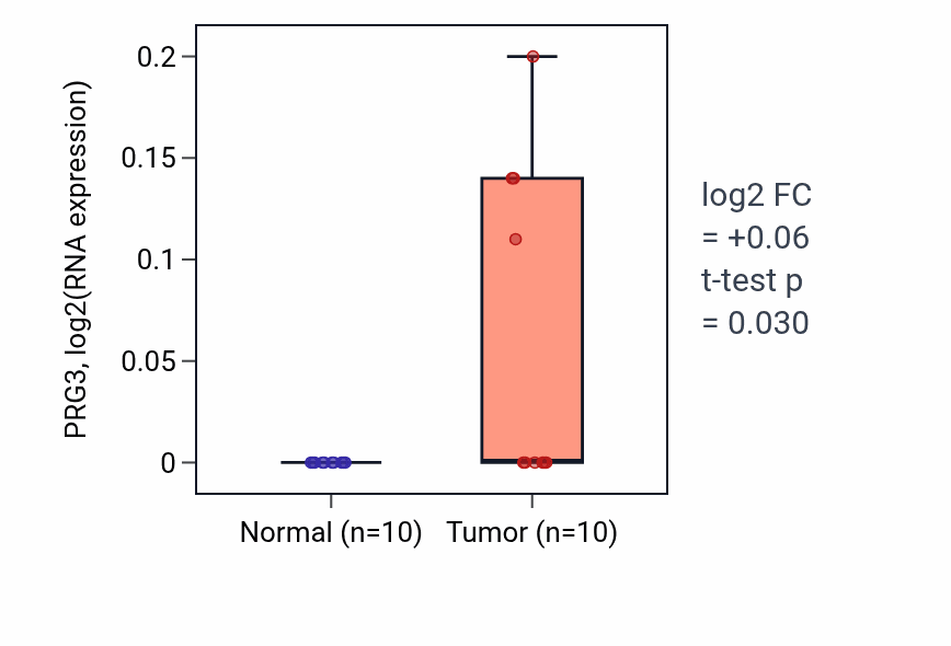 Tumor-vs-normal expression box plot for PRG3 RNA in KIRP.