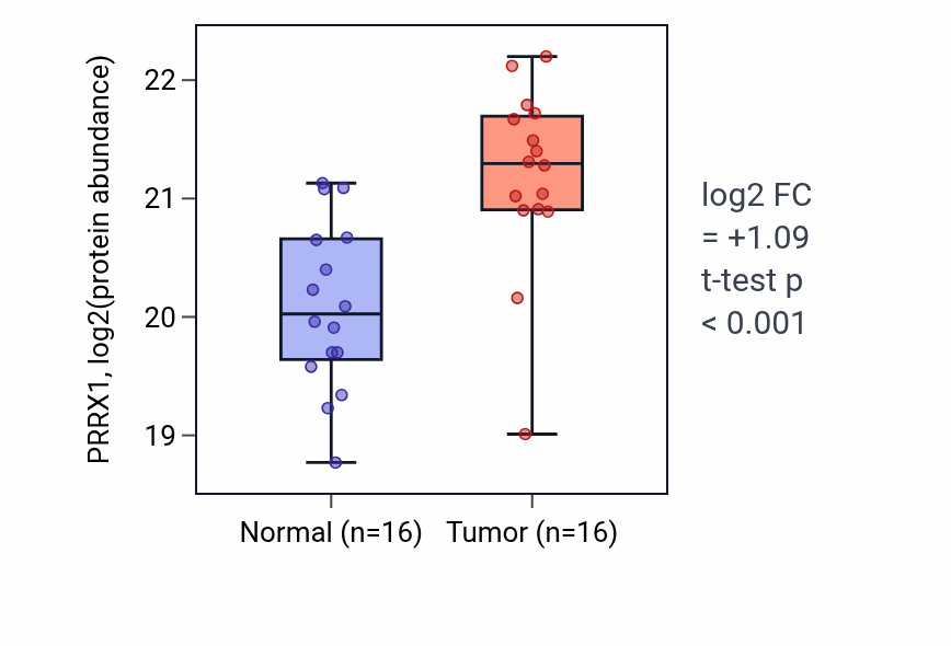 Tumor-vs-normal mass-spec protein box plot for PRRX1 in PDAC.