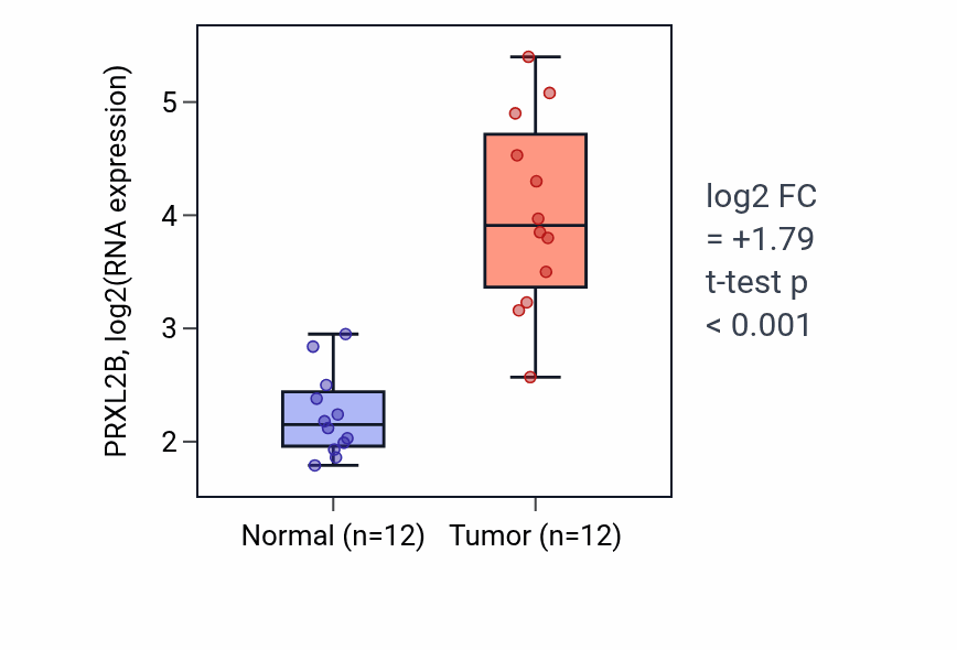 Tumor-vs-normal expression box plot for PRXL2B RNA in LIHC.
