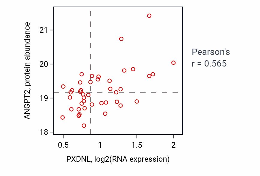 Per-sample scatter of PXDNL vs ANGPT2 in PDAC (Pearson r = 0.56).