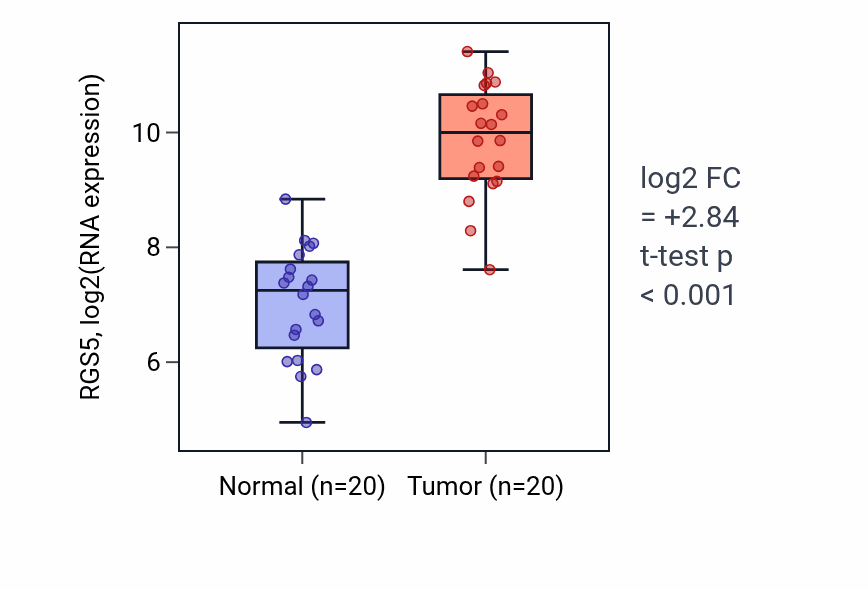 Tumor-vs-normal expression box plot for RGS5 RNA in KIRC.