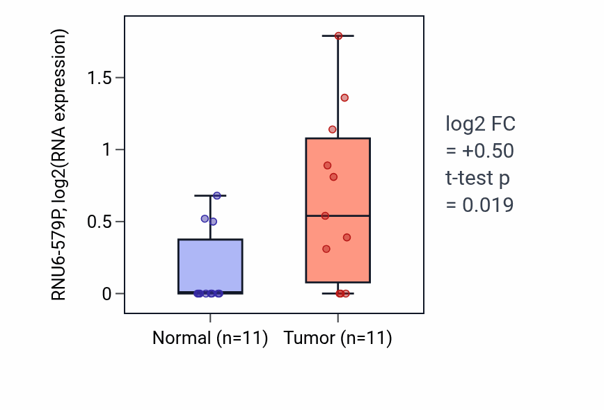 Tumor-vs-normal expression box plot for RNU6-579P in KICH.