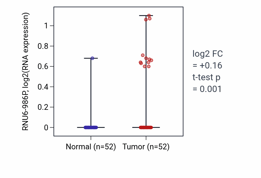 Tumor-vs-normal expression box plot for RNU6-986P in PRAD.