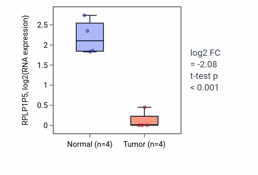 Tumor-vs-normal expression box plot for RPLP1P5 in KIRP.
