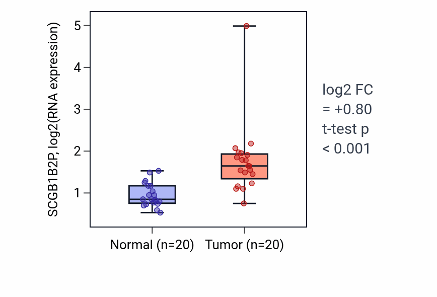 Tumor-vs-normal expression box plot for SCGB1B2P in KIRC.