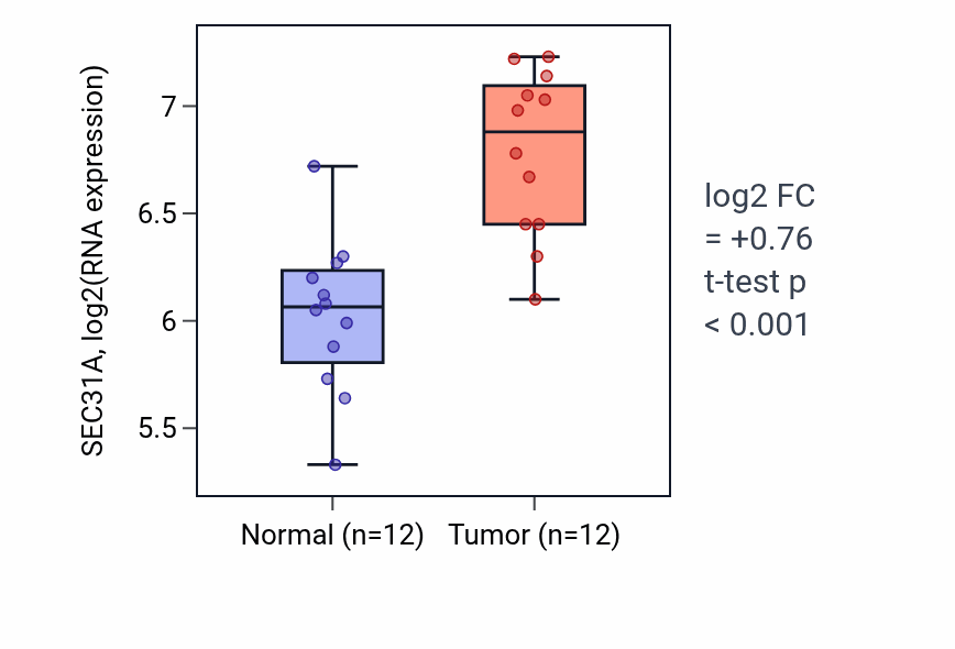 Tumor-vs-normal expression box plot for SEC31A RNA in KIRC.